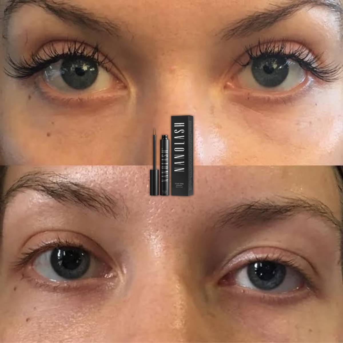 Lash Boost Serum – Longer, Fuller-Looking Lashes in 10Days