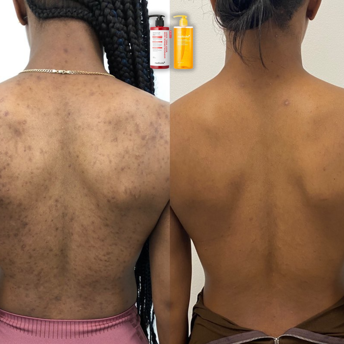 Smooth Skin Body Duo + FREE Toner Pads
