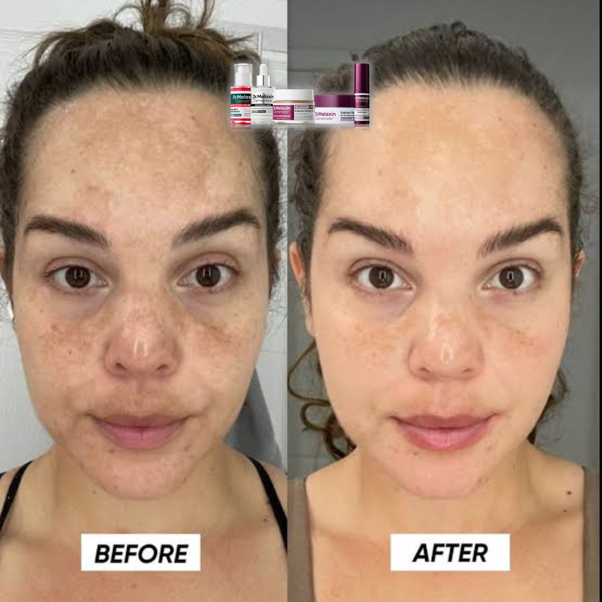 Calcium Collagen 5-Step Firming Set – Spicule Serum, Niacinamide Serum, Volume Cream, Eye Patches & Multi Balm