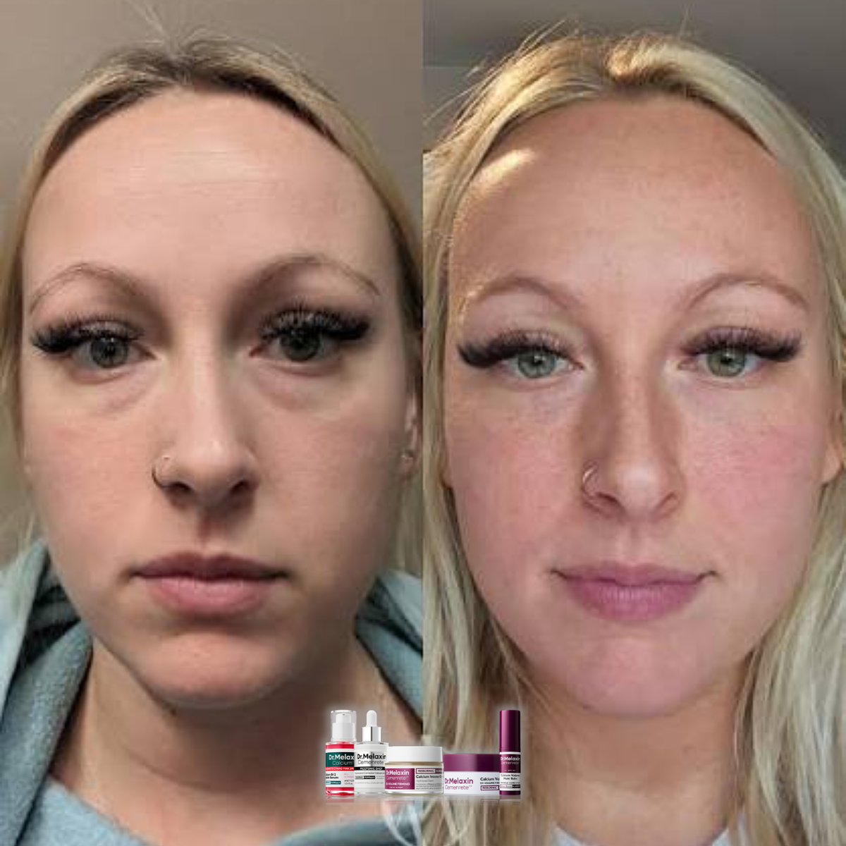 Calcium Collagen 5-Step Firming Set – Spicule Serum, Niacinamide Serum, Volume Cream, Eye Patches & Multi Balm