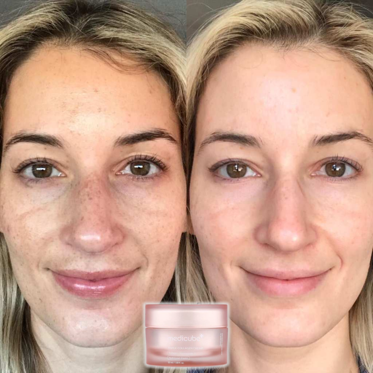 Triple Collagen Cream – Collagen, Hyaluronic Acid, Niacinamide & Shea Butter Firming Moisturiser