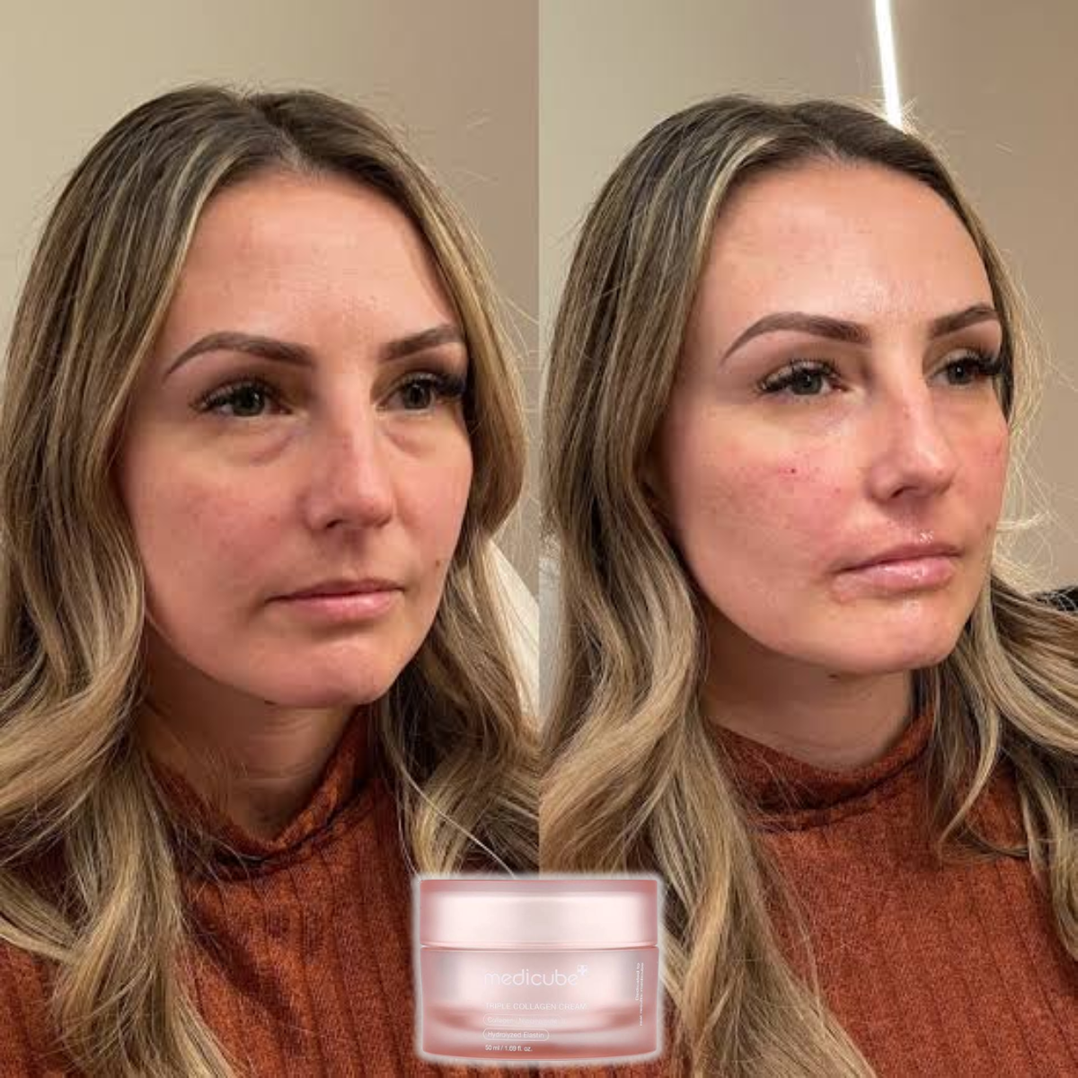 Triple Collagen Cream – Collagen, Hyaluronic Acid, Niacinamide & Shea Butter Firming Moisturiser