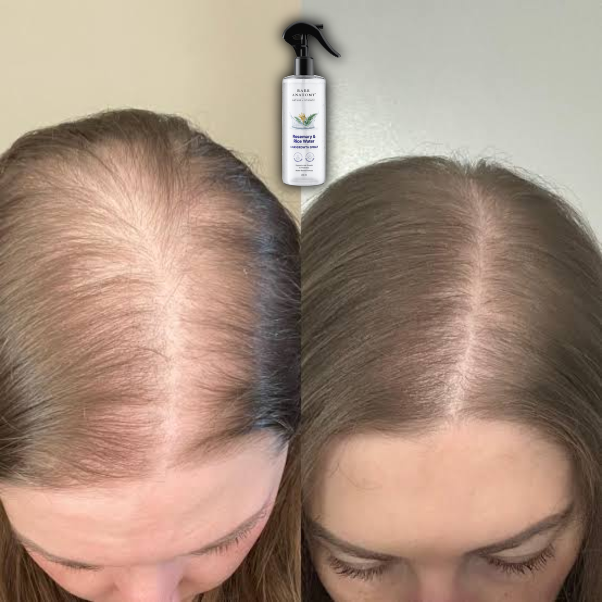 Rosemary & Rice Water Hair Spray (200ml)