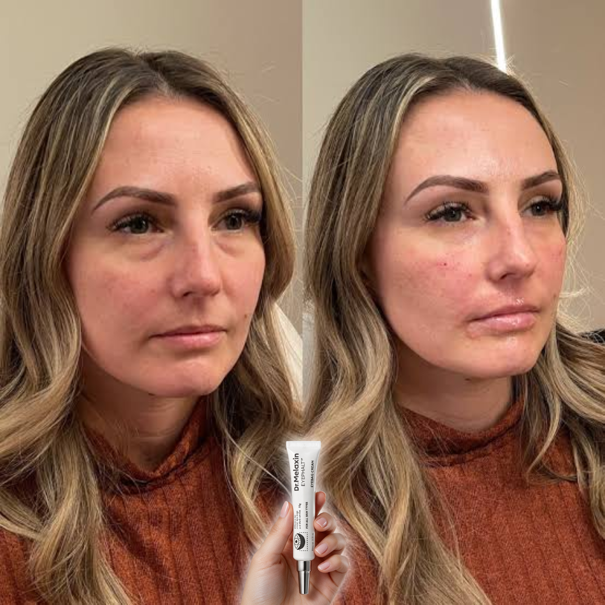 EGF Eye Bag Cream