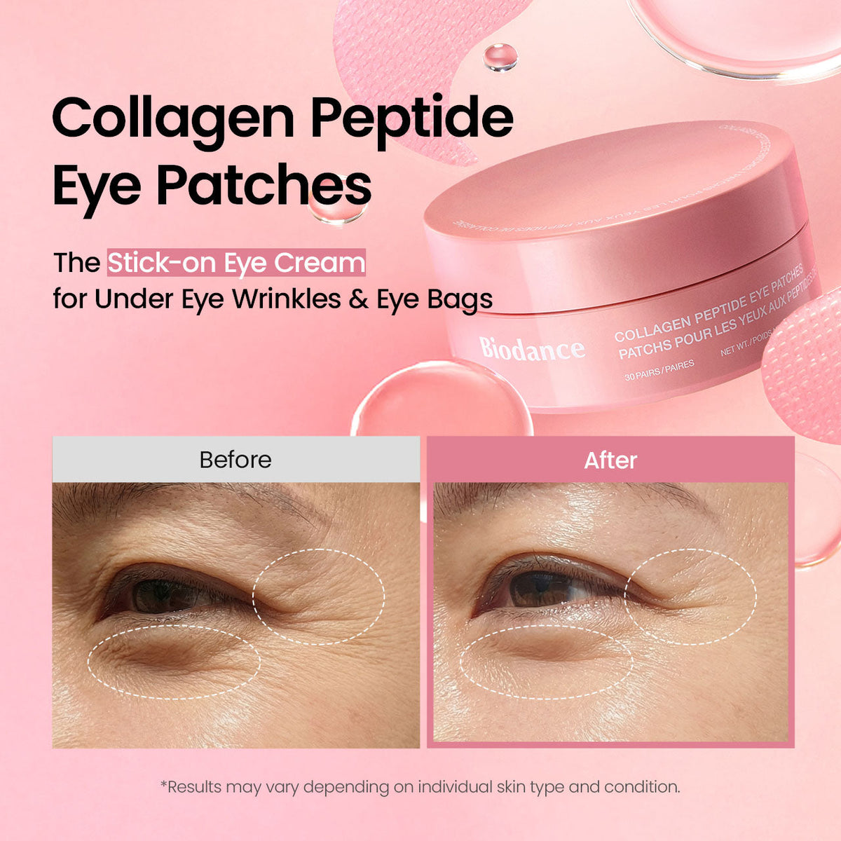 Collagen eye patch benefits
