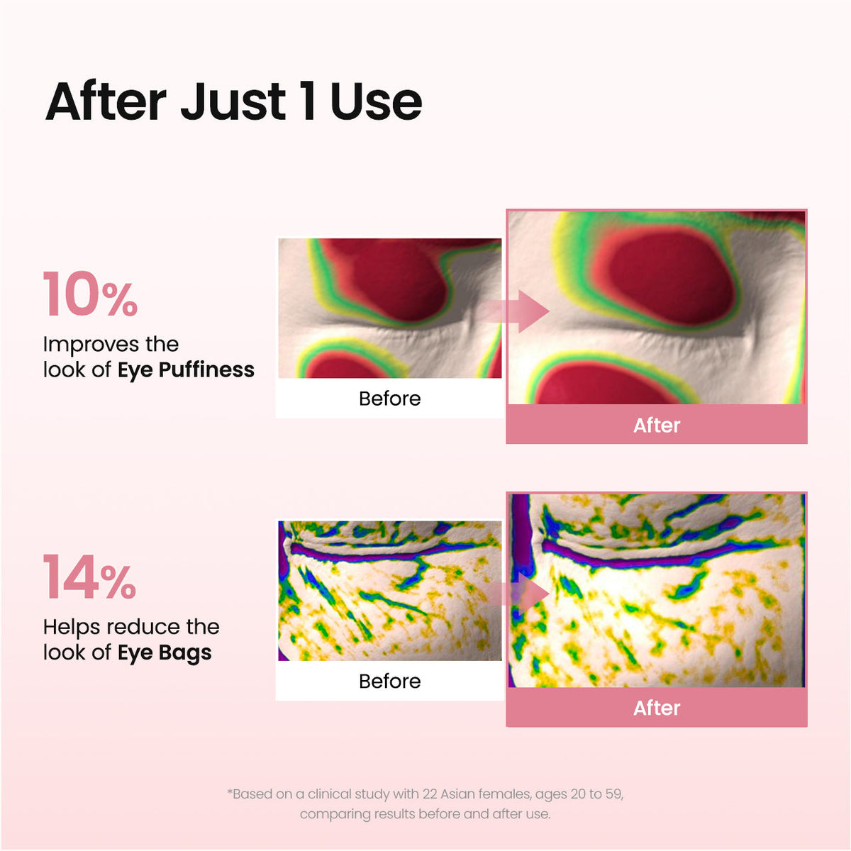 Diamond-gel patch texture
