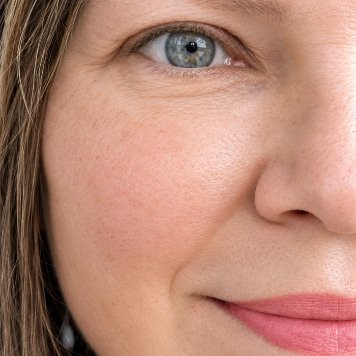 Day 15 – Smile lines · 15 days